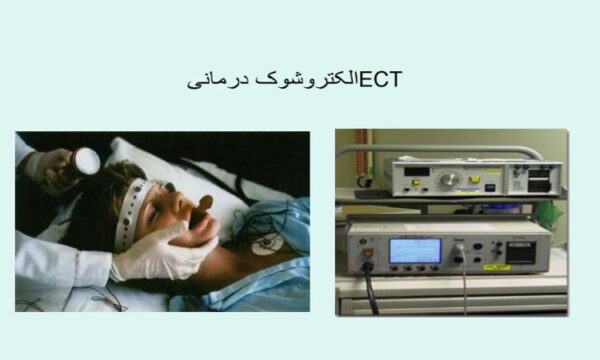 پاورپوینت الکتروشوک درمانیECT
