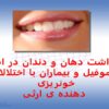 پاورپوینت بهداشت دهان و دندان در افراد هموفیل و بیماران با اختلالات خونریزی دهنده ی ارثی