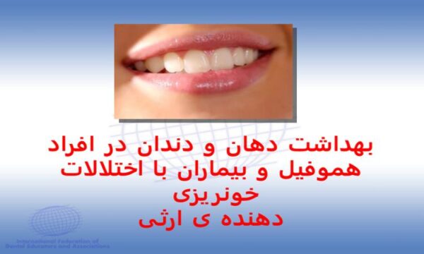 پاورپوینت بهداشت دهان و دندان در افراد هموفیل و بیماران با اختلالات خونریزی دهنده ی ارثی