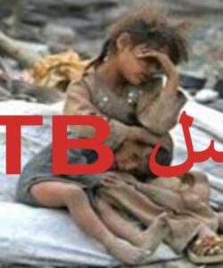 پاورپوینت سل TB