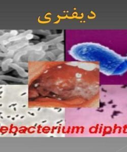 دیفتری ppt