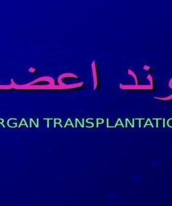 پاورپوینت پيوند اعضاء