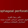 پاورپوینت پرفوراسیون مری