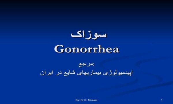 سوزاک