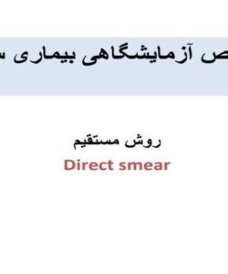 تشخیص-آزمایشگاهی-بیماری-سل