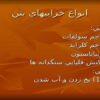 انواع-خرابيهاي-بتن