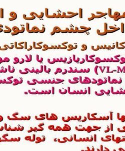 لارو-مهاجر-احشایی-و-التهاب-داخل-چشم-نماتودی