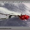 تشخيص-و-اصلاح-غلبه-مزاج-بلغم