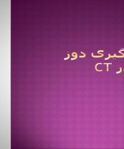 اندازه-گیری-دوز-بیمار-در-سی-تی-اسکن