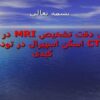 بررسی-دقت-تشخيص-MRI