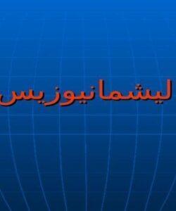ليشمانيوزيس