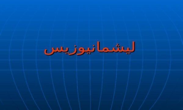 ليشمانيوزيس