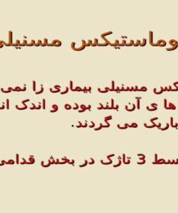کیلوماستیکس-مسنیلی