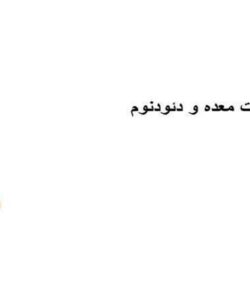اختلالات-معده-و-دئودنوم