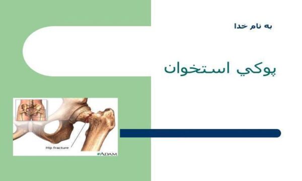 پوكی-استخوان