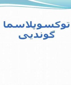 توکسوپلاسما-گوندیی