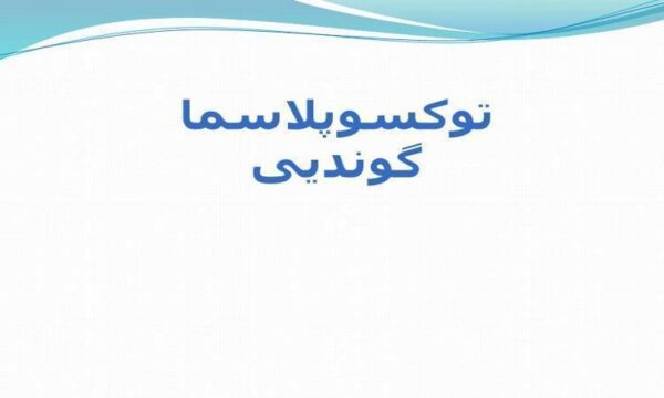 توکسوپلاسما-گوندیی