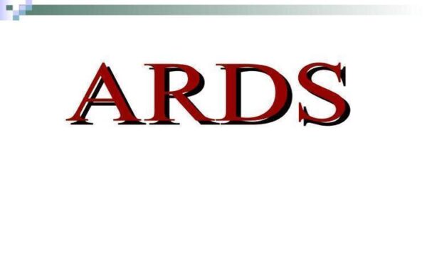پاورپوینت-ARDS-